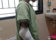 Remaja 15 Tahun Dibakar Paman di Semarang, Dipicu Hal Sepele: Polisi Buru Pelaku