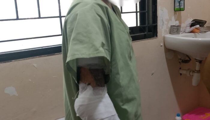 Remaja 15 Tahun Dibakar Paman di Semarang, Dipicu Hal Sepele: Polisi Buru Pelaku