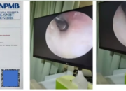 Terungkap! Peserta UTBK SNBT di Undip Tanam Alat di Telinga, Terendus Metal Detector Saat Mau Ujian Kedokteran