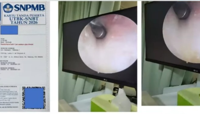 Terungkap! Peserta UTBK SNBT di Undip Tanam Alat di Telinga, Terendus Metal Detector Saat Mau Ujian Kedokteran