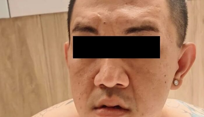 DPO ‘The Doctor’ Dibekuk di Malaysia! Bandar Narkoba Otak Pelarian Ko Erwin Akhirnya Tertangkap